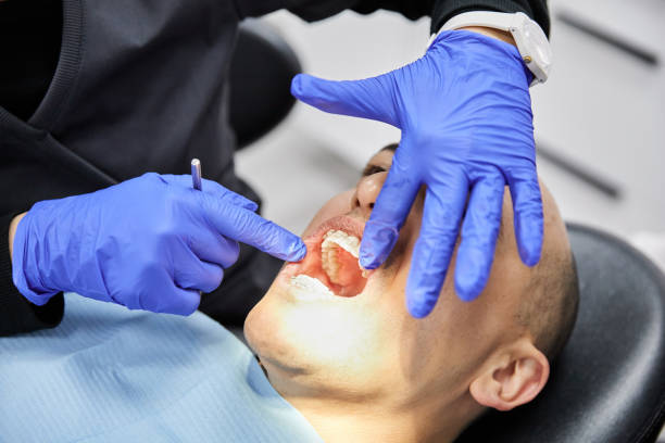 Best Broken or Cracked Tooth Emergency Dentist in Parkville, MD